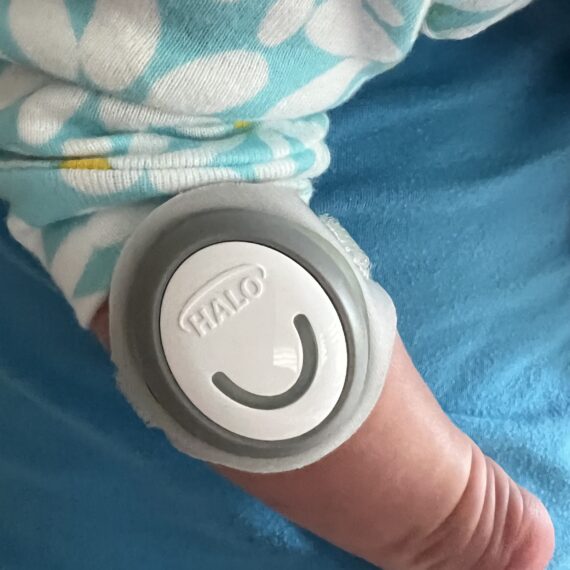 HALO SleepSure Wearable Monitor worn on baby's leg